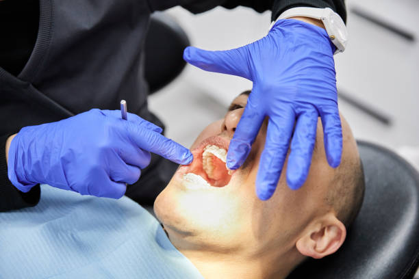 Best Emergency Dentist for Knocked-Out Tooth in St Francis, WI